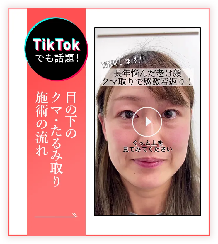 目の下のクマ・たるみ取り 施術中動画