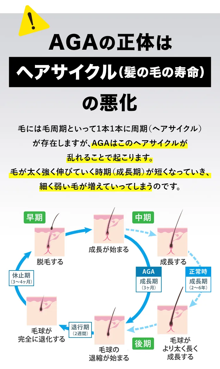 AGAの正体はヘアサイクル（髪の毛の寿命）の悪化