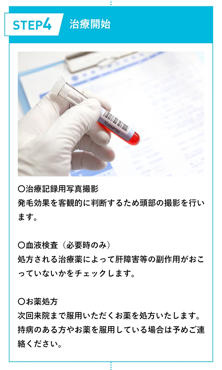 ステップ4 治療開始