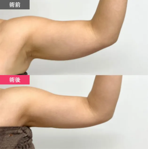 症例写真