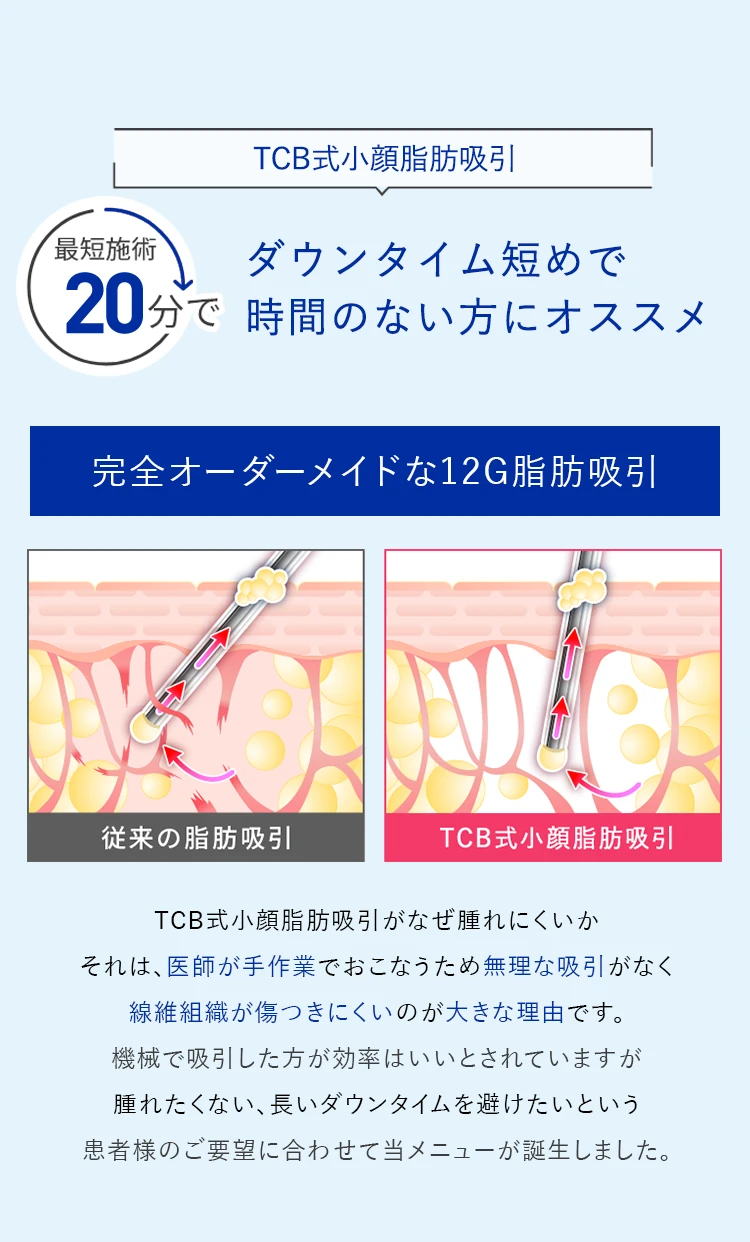 TCB式小顔脂肪吸引｜完全オーダーメイドな12G脂肪吸引