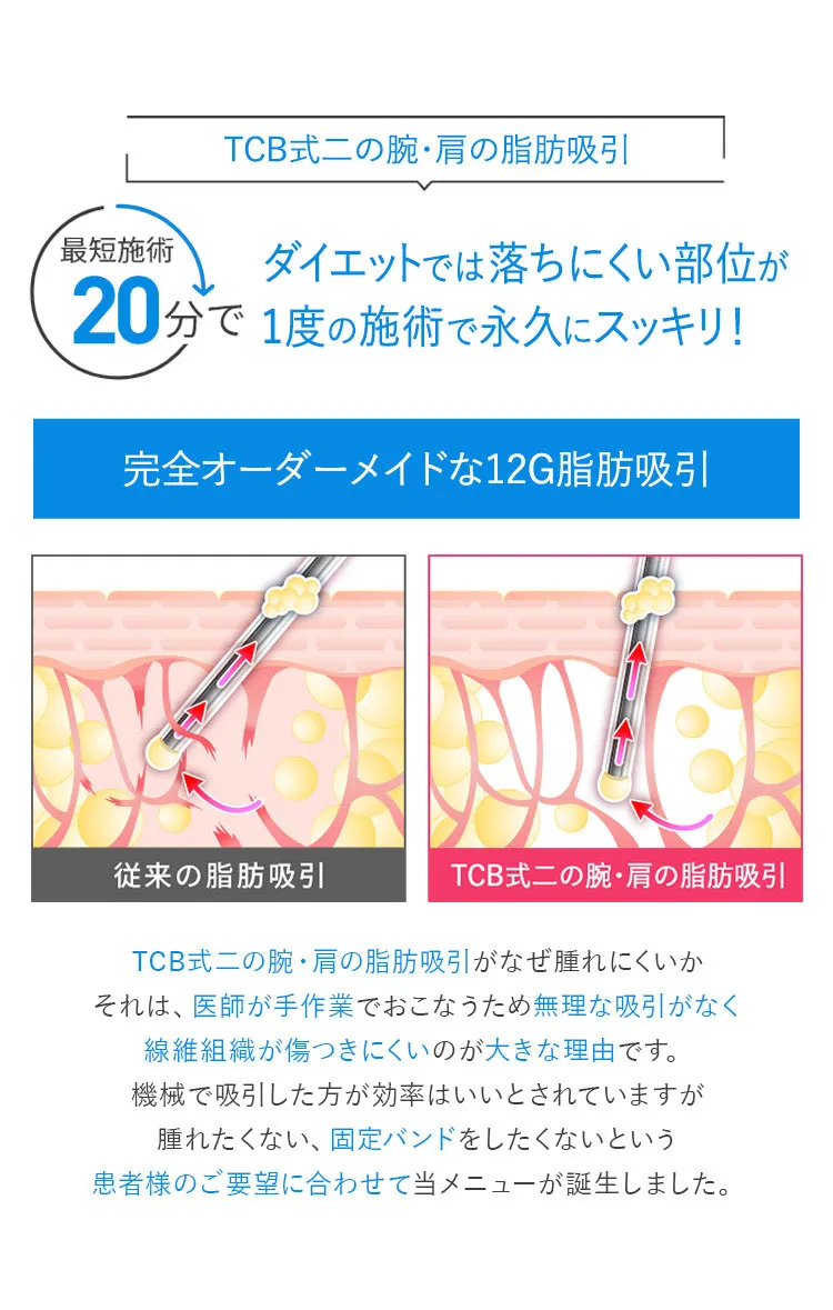 TCB式二の腕・肩の脂肪吸引｜完全オーダーメイドな12G脂肪吸引