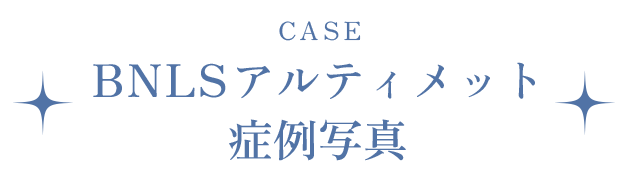 BNLSアルティメット症例写真