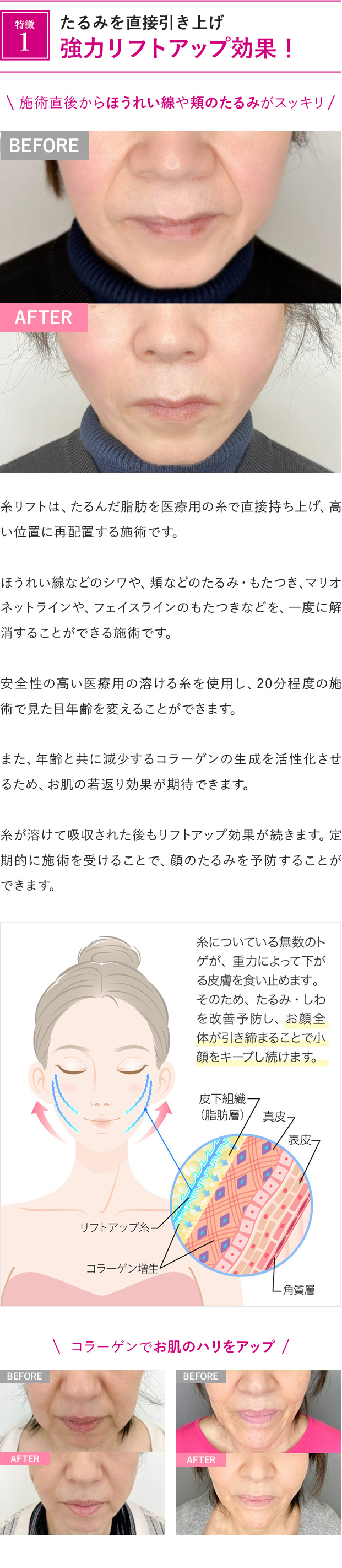 特徴1