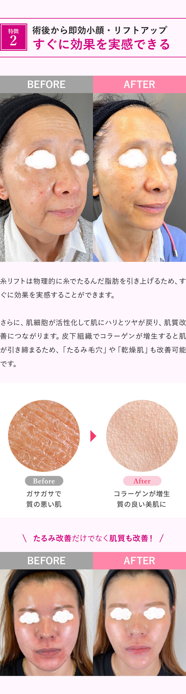 特徴2