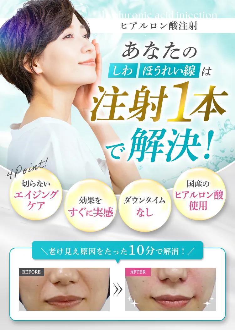 しわ、ほうれい線は注射1本で解決！