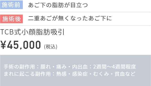 施術前