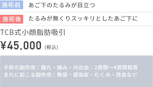 施術前