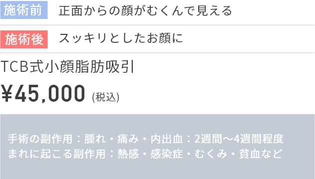 施術前