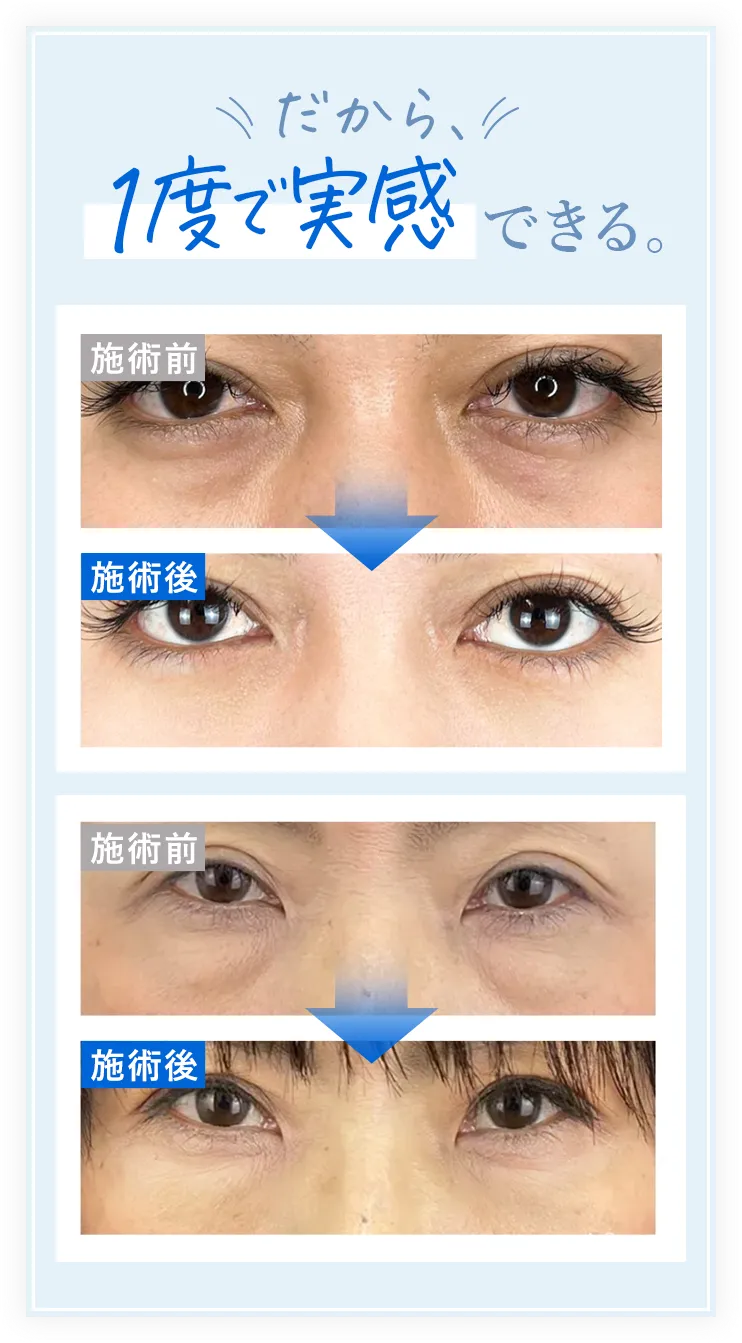 1度で実感できる