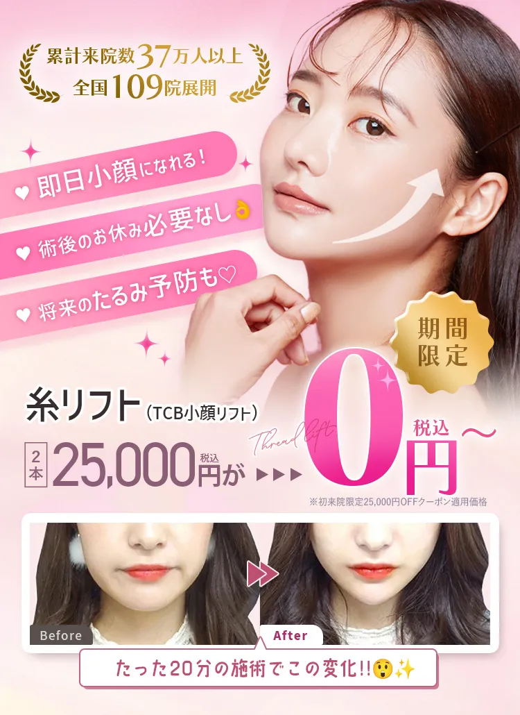 糸リフト(TCB式小顔リフト)期間限定0円
