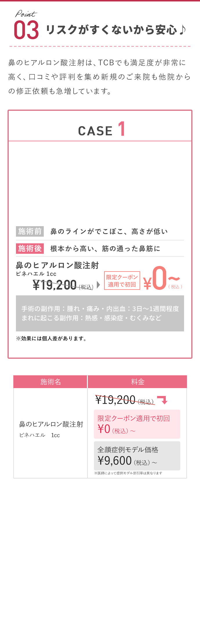 リスクが少ないから安心