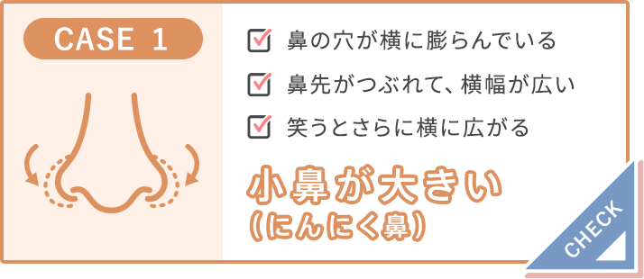 小鼻が大きい（にんにく鼻）