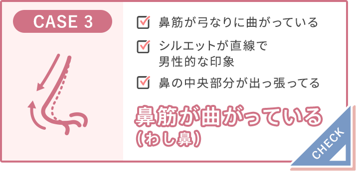 筋が曲がっている（わし鼻）