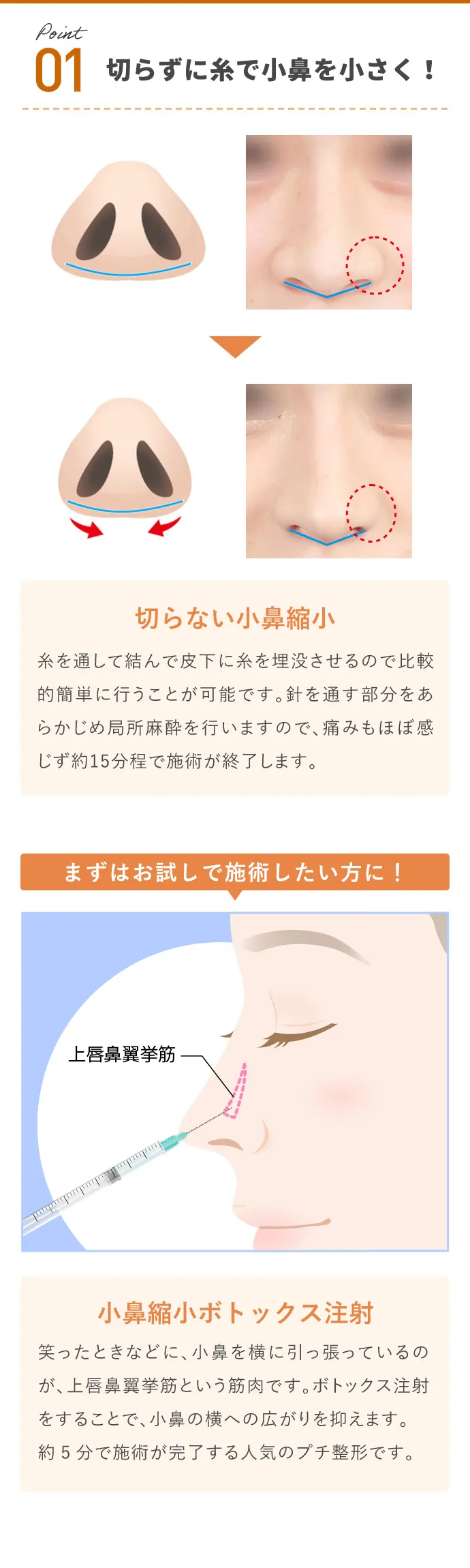 切らずに糸で小鼻を小さく！