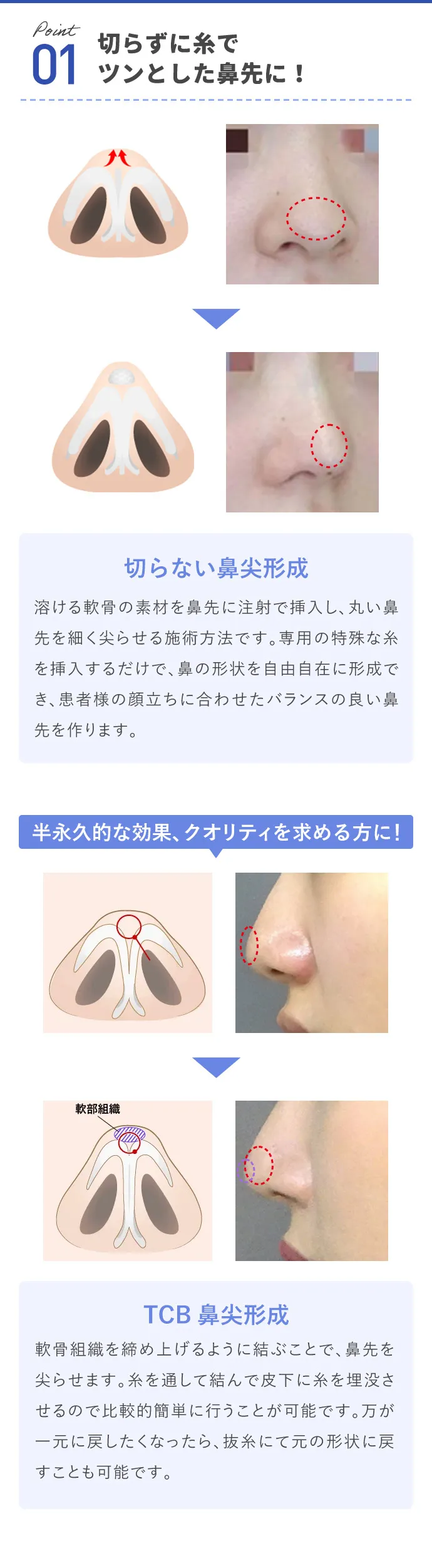 切らずに糸でツンとした鼻先に！