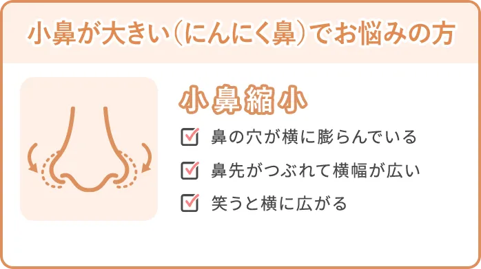 小鼻が大きいにんにく鼻でお悩みの方