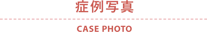 症例写真