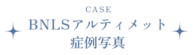 BNLSアルティメット症例写真