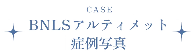 BNLSアルティメット症例写真
