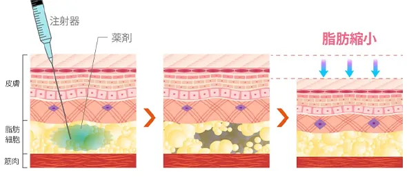 脂肪縮小の仕組み