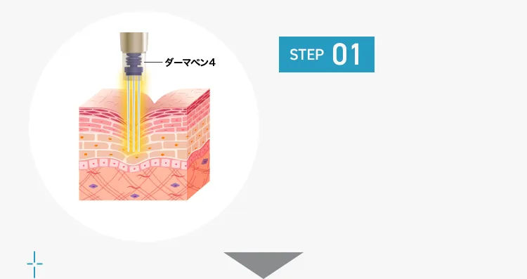 STEP01