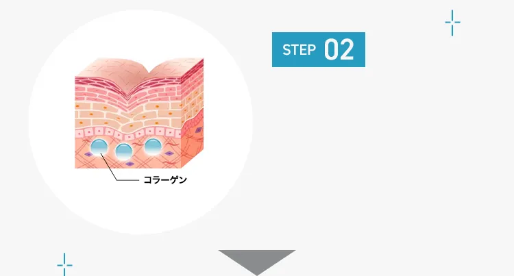 STEP02