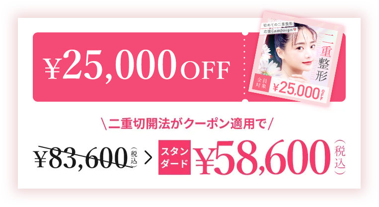 WEB予約限定クーポン配布中　￥25,000OFF web