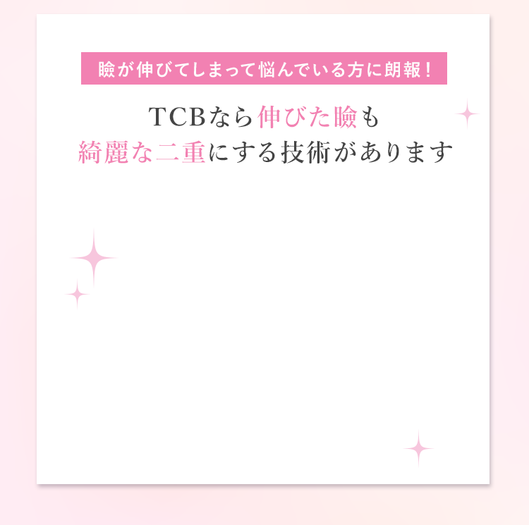 瞼が伸びてしまって悩んでいる方に朗報！