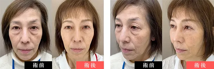 症例写真