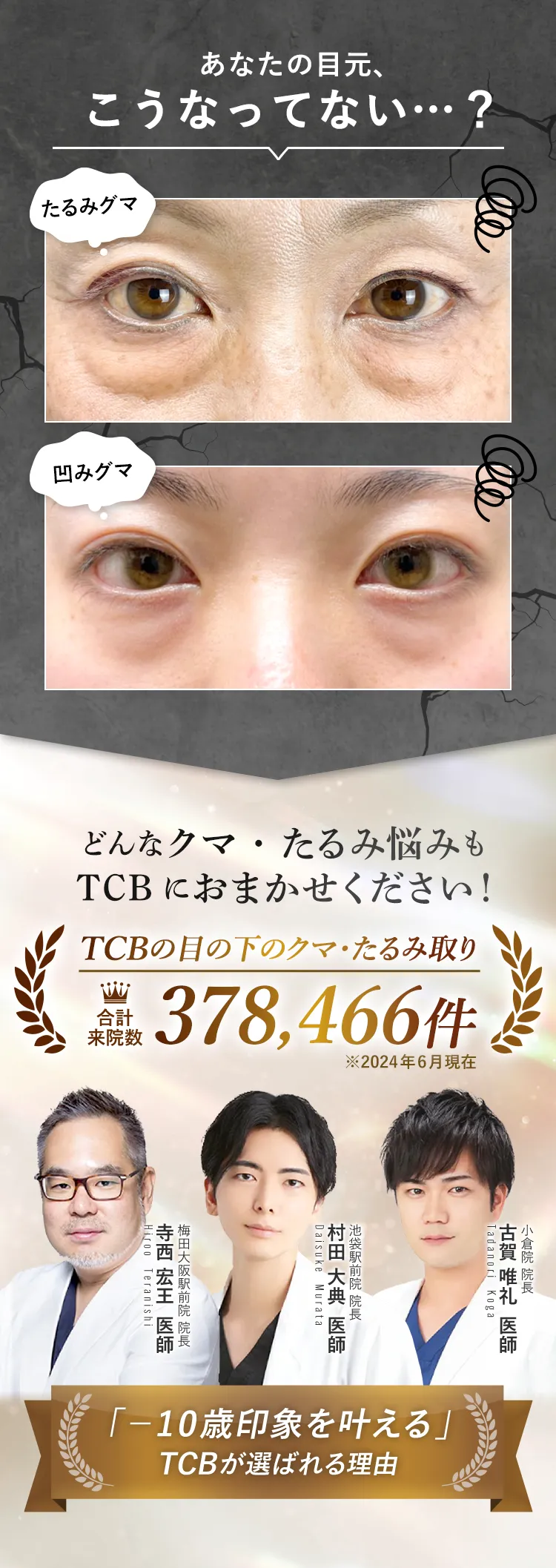 どんなクマ・たるみ悩みもTCBにおまかせください!