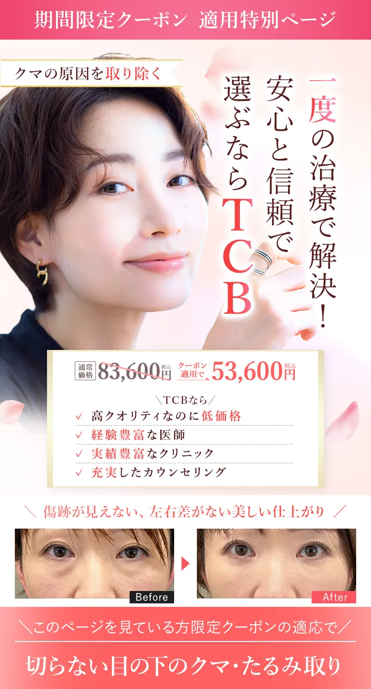 TCB式 切らない目の下のクマ・たるみ取り セルフケアでは消えない?美容医療で即日時短解決!