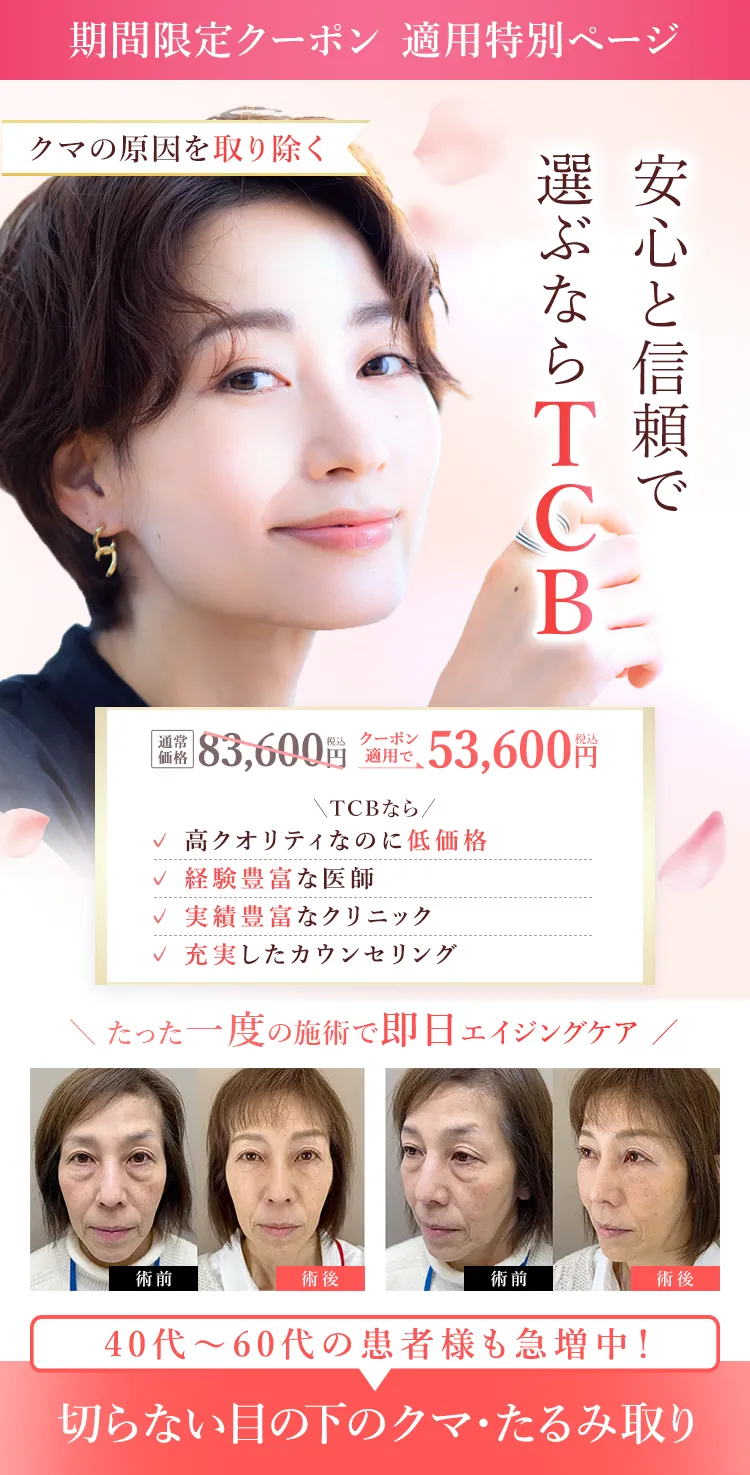TCB式 切らない目の下のクマ・たるみ取り セルフケアでは消えない?美容医療で即日時短解決!