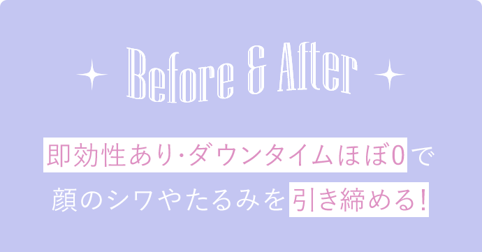 ビフォー・アフター