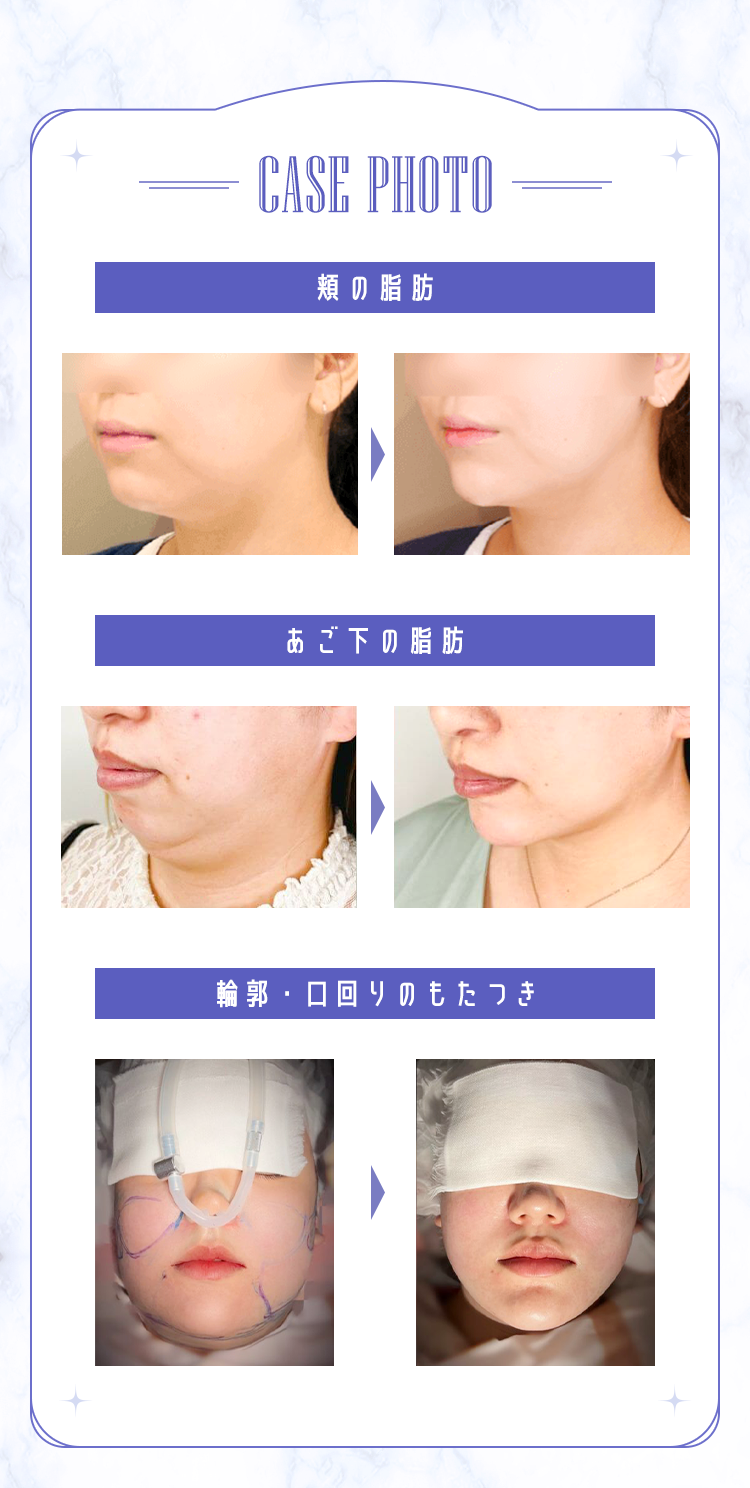 CASE PHOTO