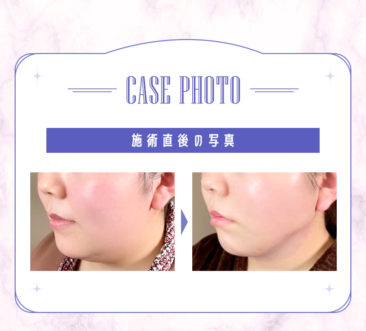 CASE PHOTO