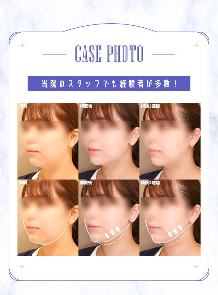 CASE PHOTO
