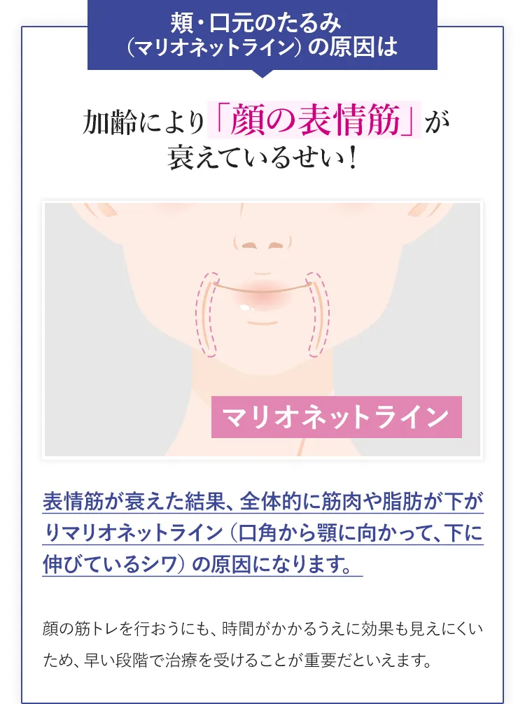 頬・口元のたるみは(マリオネットライン)の原因は加齢により「顔の表情筋」が衰えているせい!
