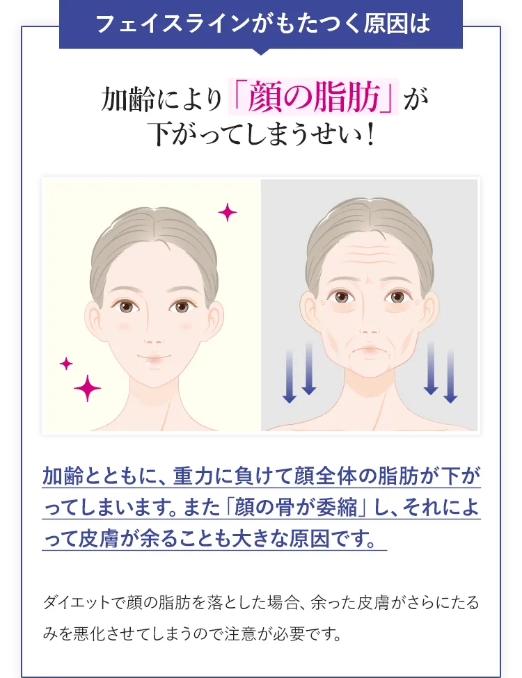 フェイスラインがもたつく原因は加齢により「顔の脂肪」が下がってしまうせい!