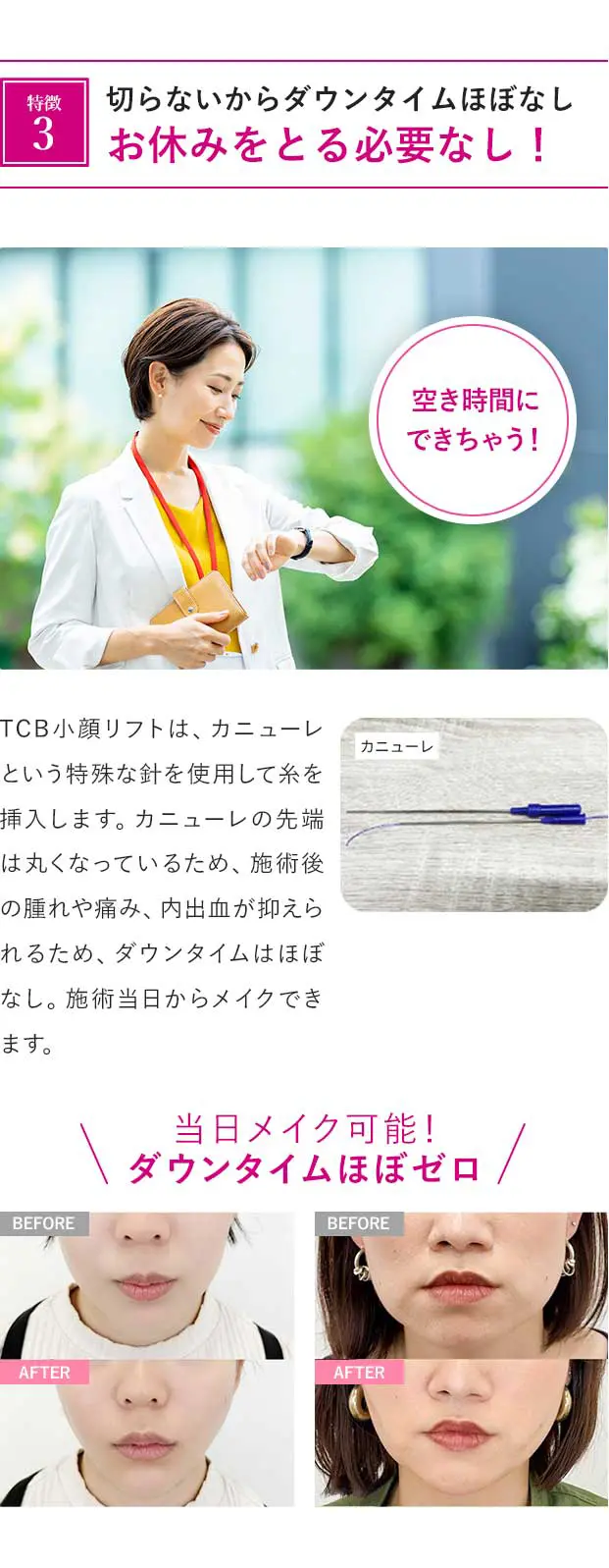 特徴3