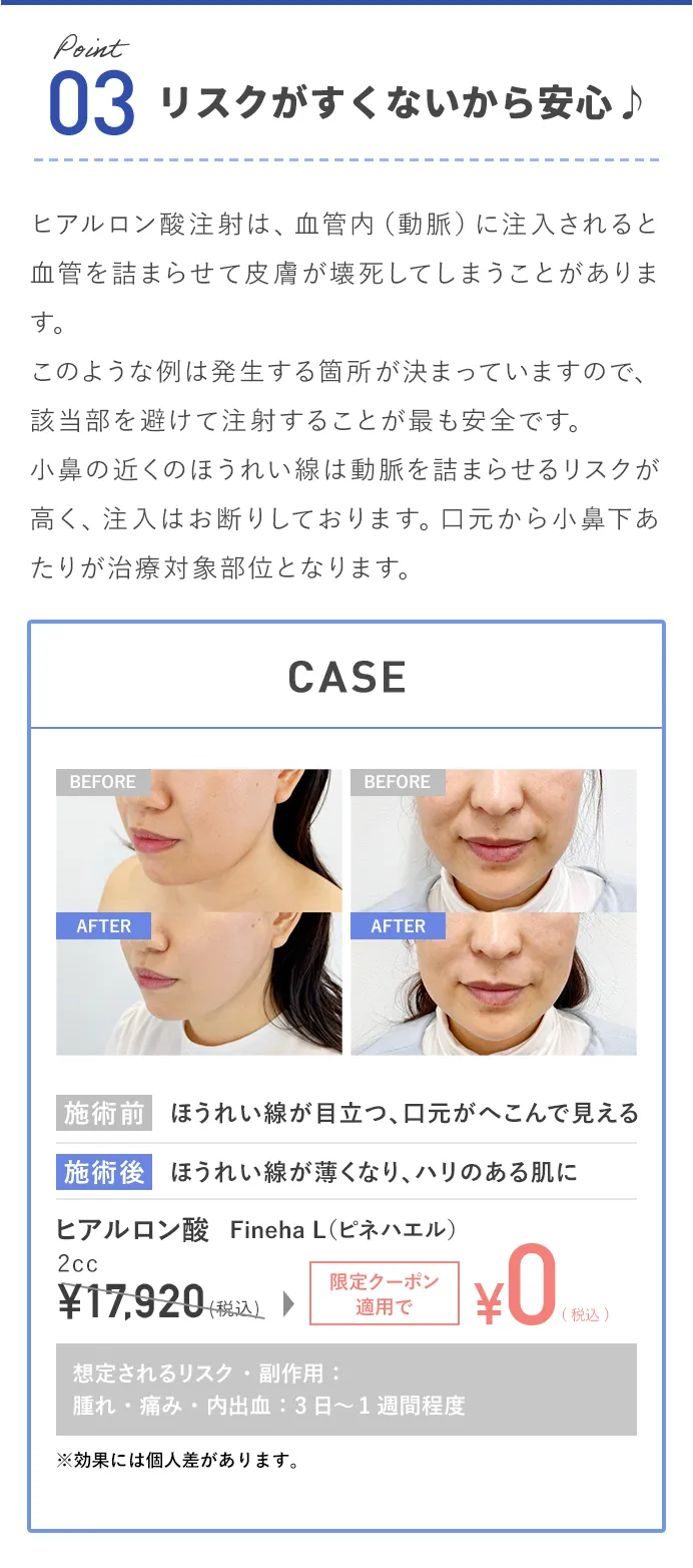 リスクがすくないから安心♪