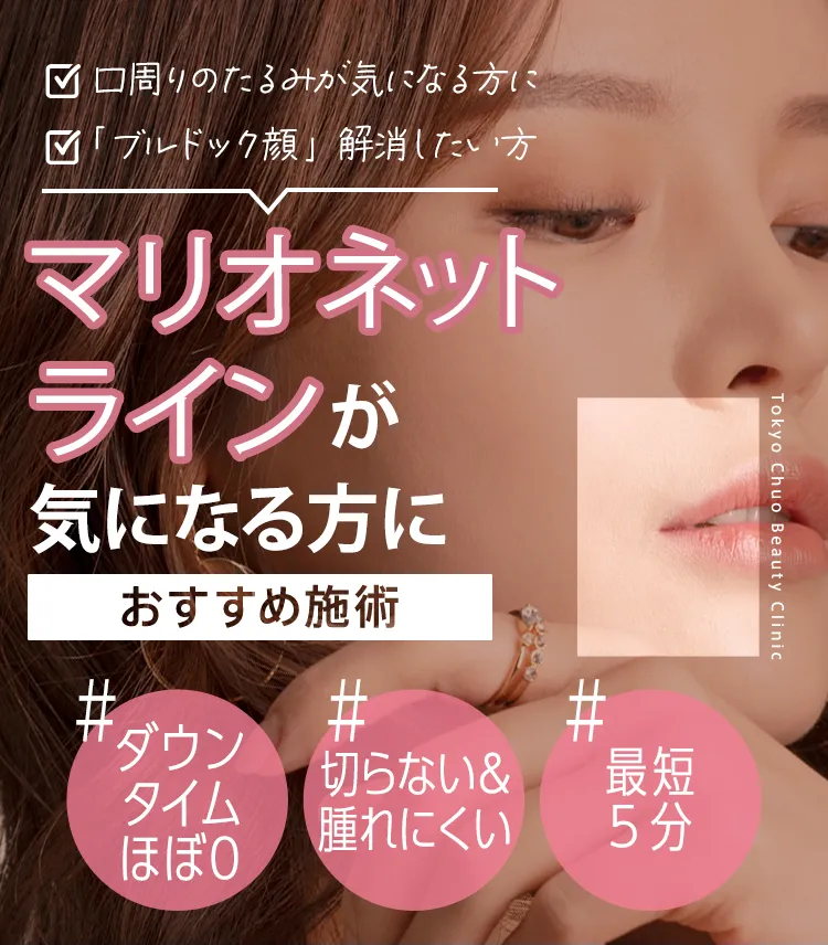 マリオネットラインを消す