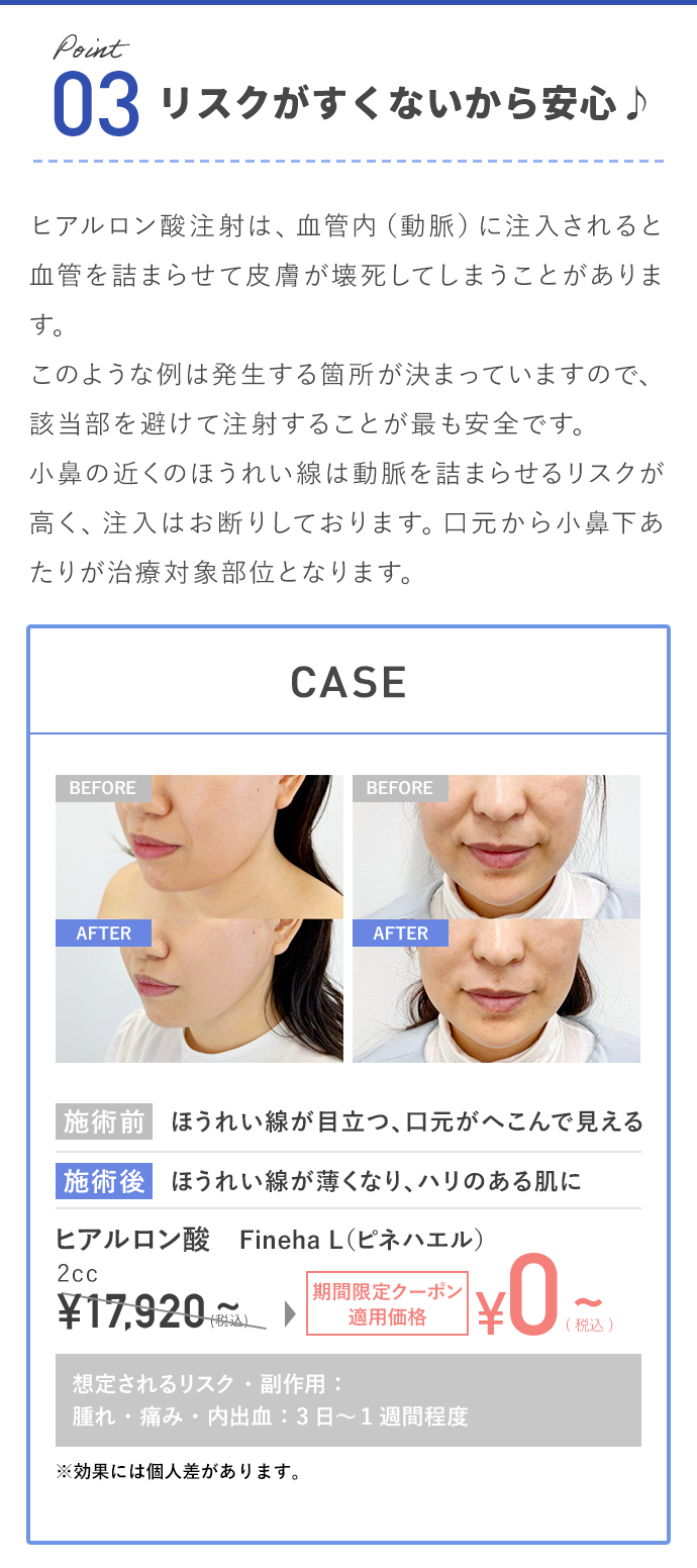 リスクがすくないから安心♪