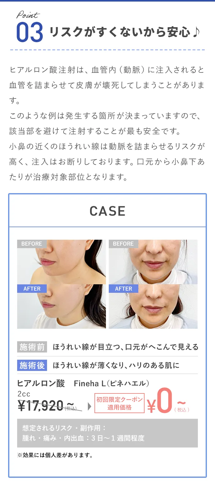 リスクがすくないから安心♪