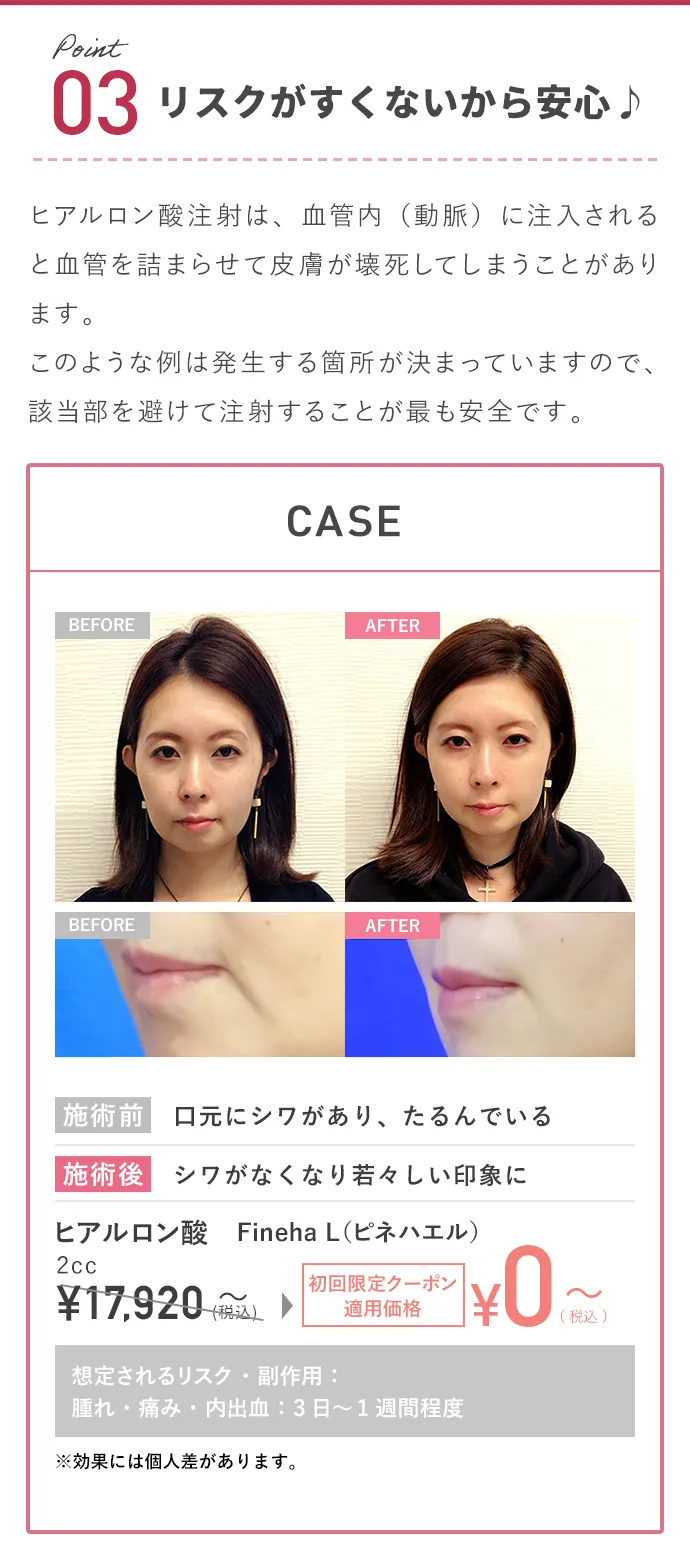 リスクがすくないから安心♪