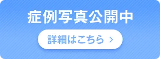 症例写真公開中 詳細はこちら