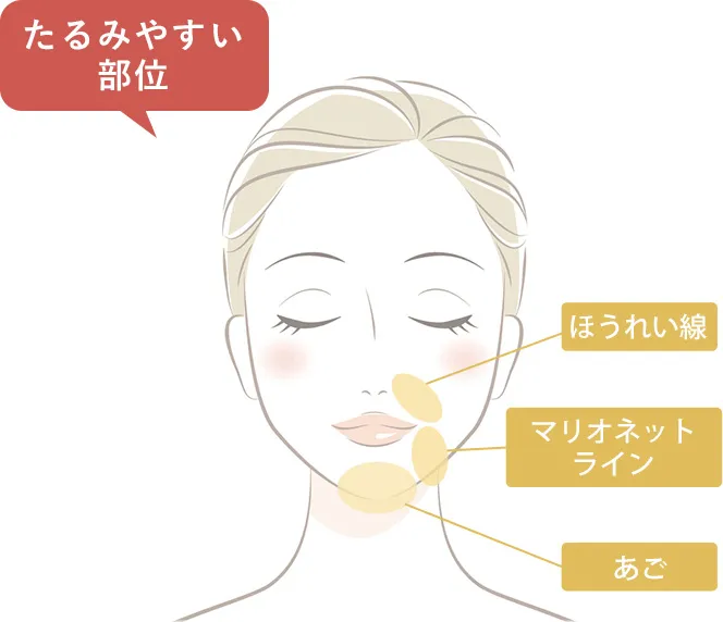 たるみやすい部分