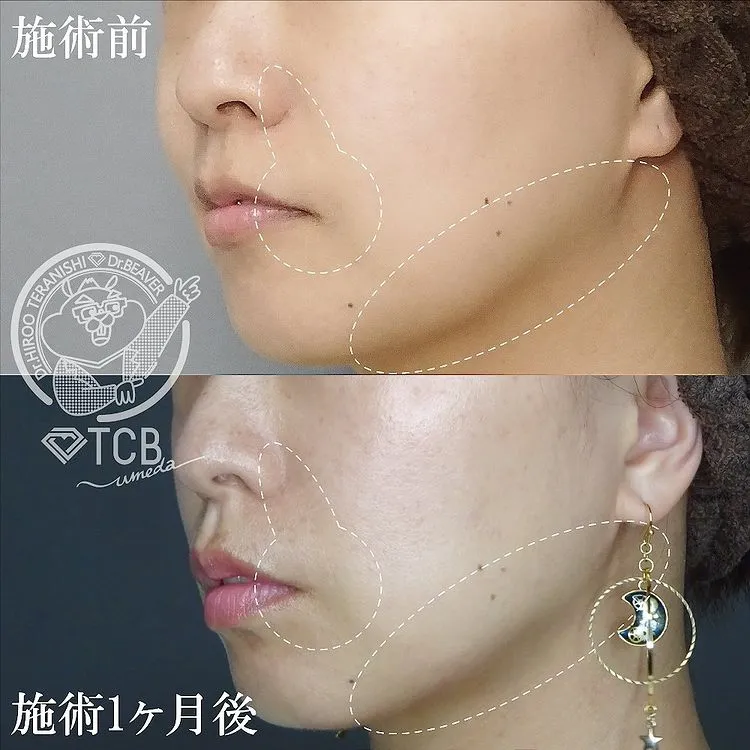 keisoku__case_content