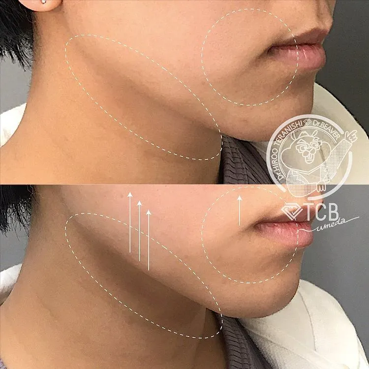 keisoku__case_content