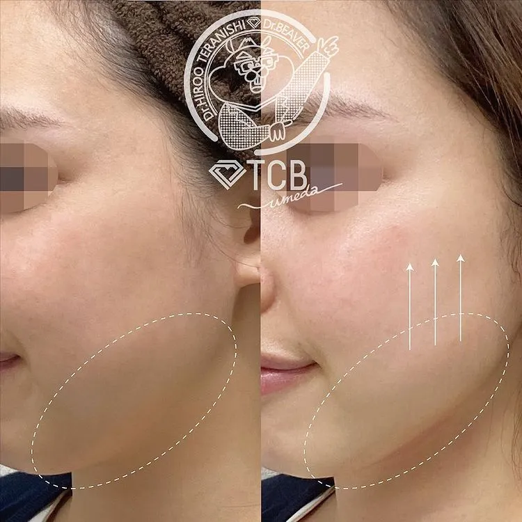 keisoku__case_content